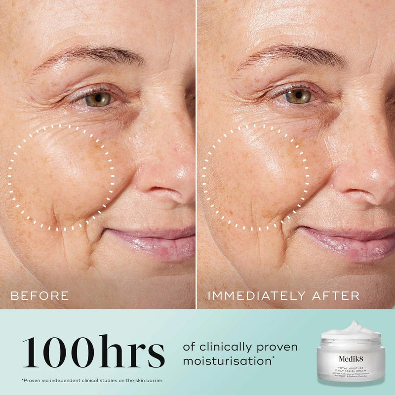 Medik8 Moisturiser Medik8 Total Moisture Daily Facial Cream, 50m