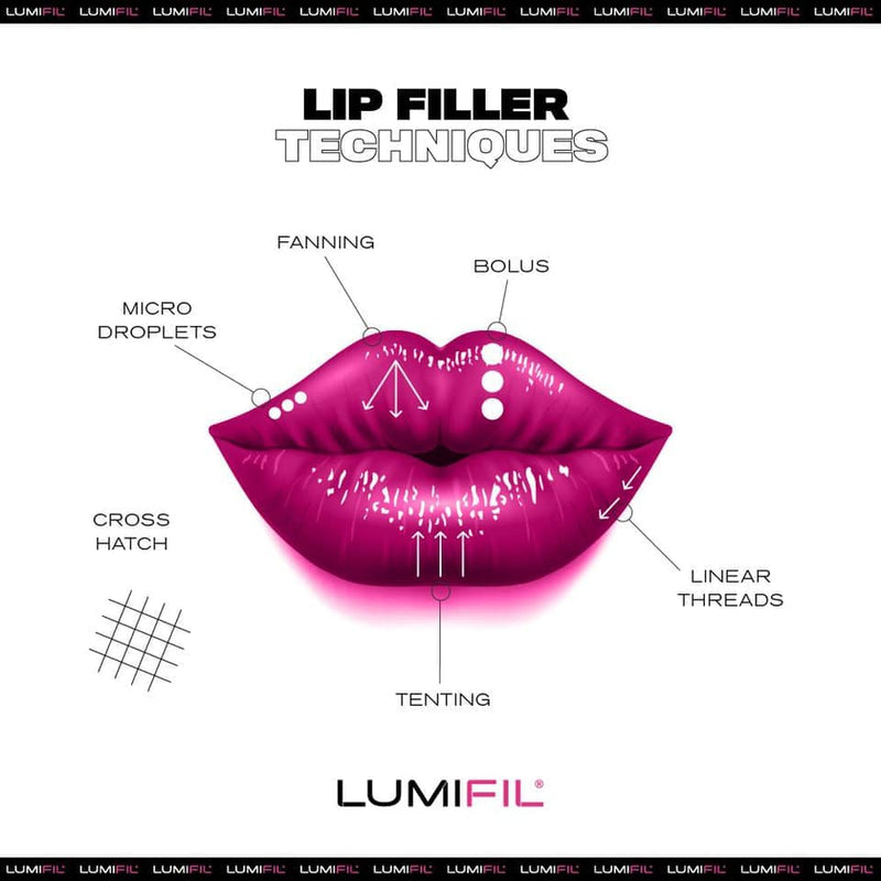 Lumifil Filler Lumifil L-Kiss, 1ml