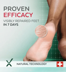 Poderm Foot Serum Poderm Very Dry and Damaged Feet Serum 75ml